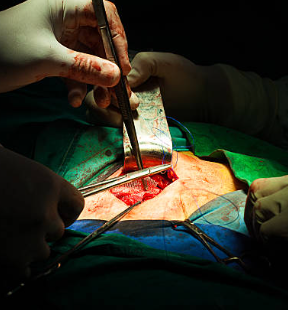 Procedure