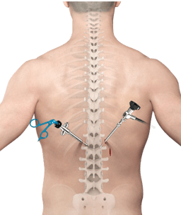 Procedure